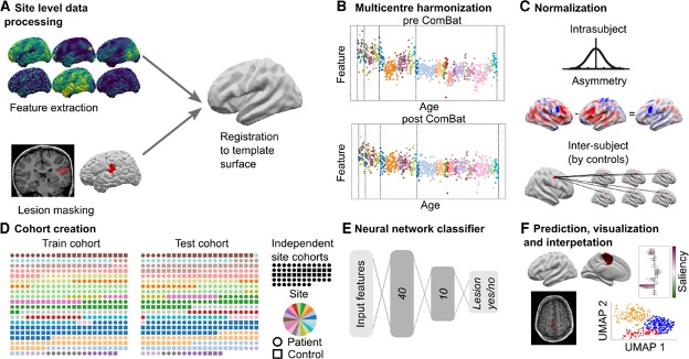 MELD Surface-based FCD Classifier – MELD Project